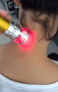Terapia con láser