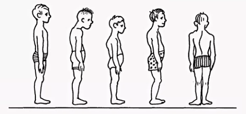 Violación de la postura