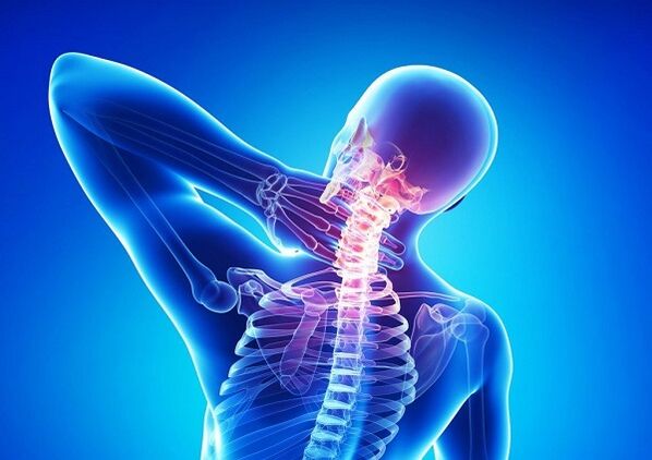 Dolor en la columna cervical con osteocondosis