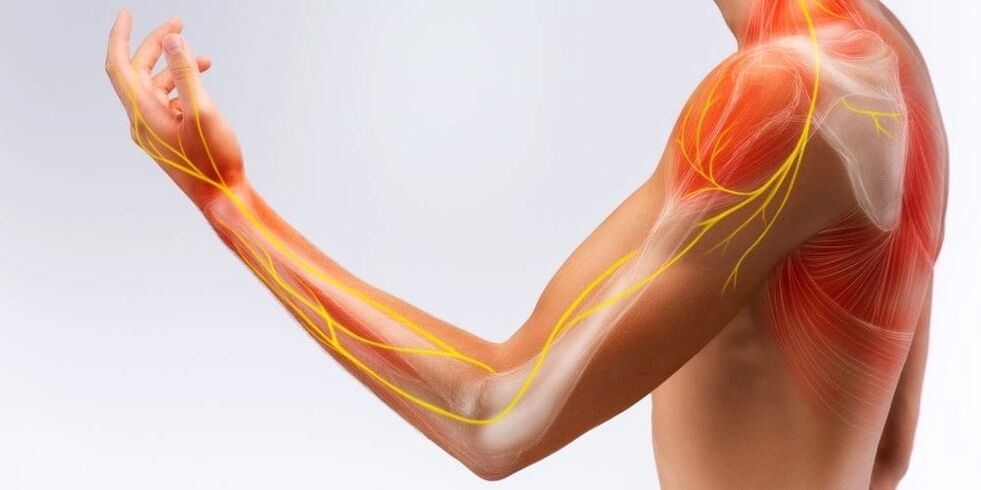 El dolor y el entumecimiento en los dedos indican daño en los ligamentos debido a ligamentitis estenosante.