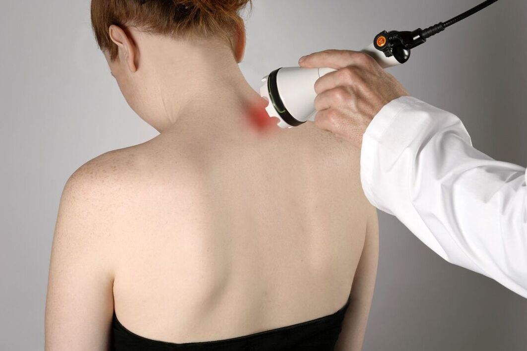 tratamiento fisioterapéutico de la osteocondrosis cervical